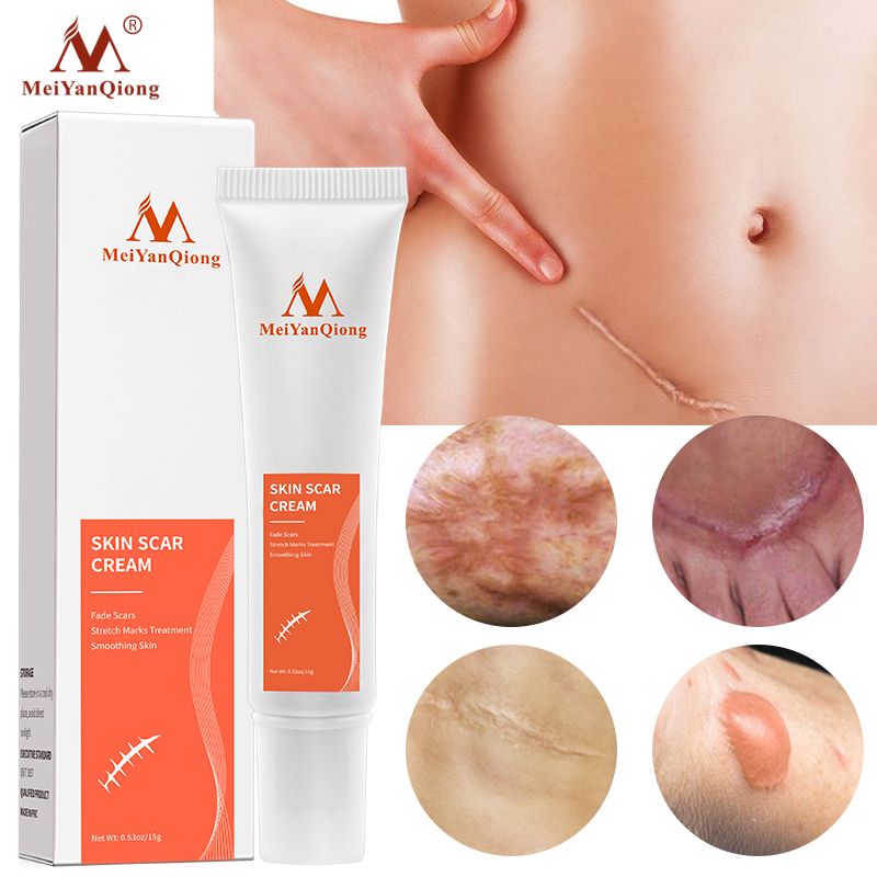 MeiYanQiong Acne Scar Remove Scar Cream Skin Repair Stretch Marks