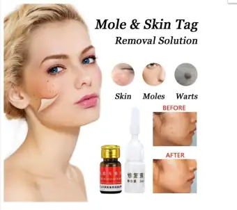 dark spot removal homeopathic cream