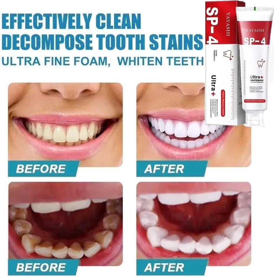 YAYASHI SP-4 Probiotic Whitening Toothpaste – Ultra+ Stain Removal, Fresh Breath & Dental Hygiene – Professional Care (120g)