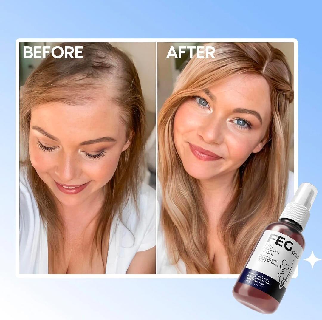 FEG plus Hair growth serum And Spray 50 ml,beard growth serum foe hairloss control & hair growth for men &women