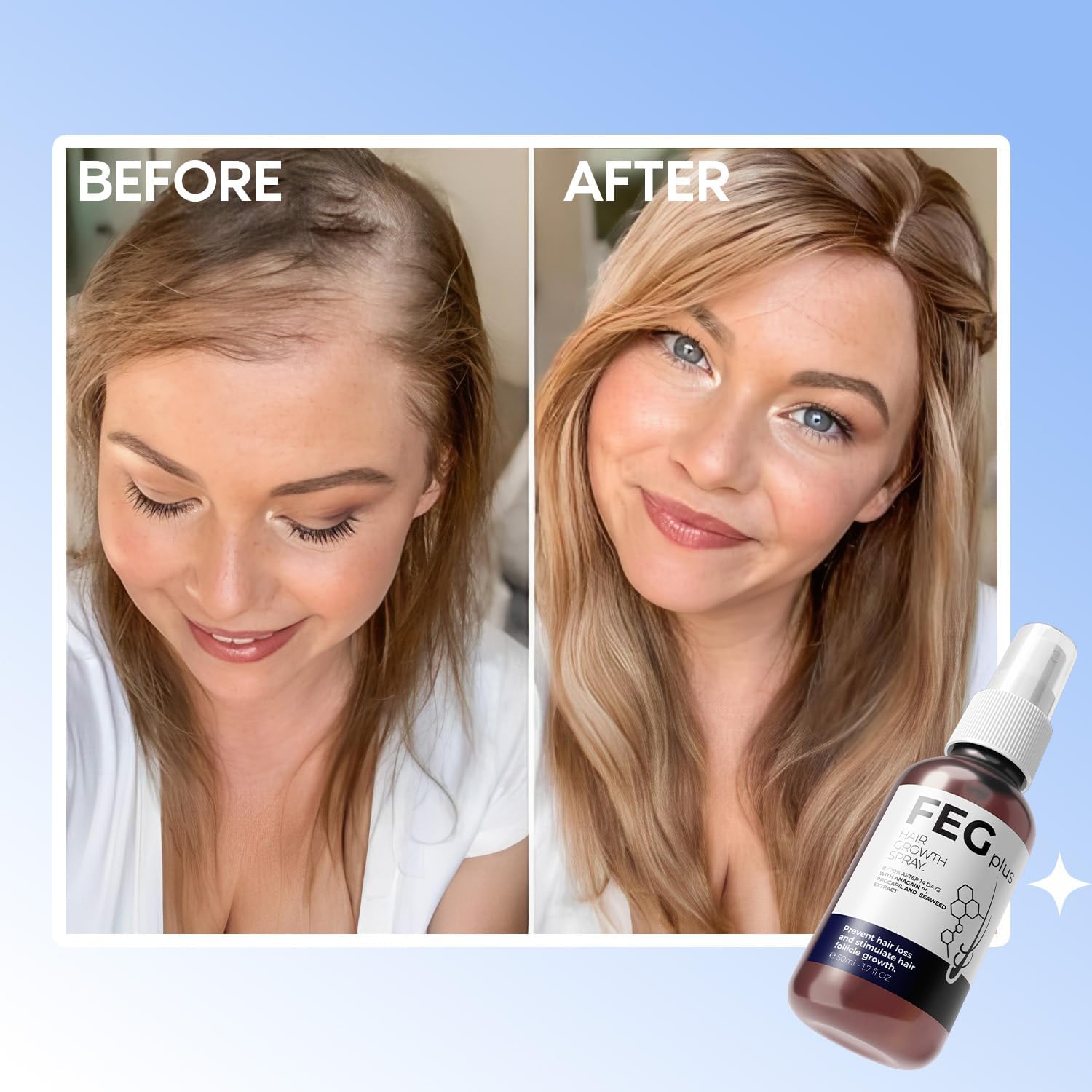 FEG PLUS Hair Growth SERUM and SPRAY 50ml For Men and Women, Hair & Beard Growth Oil