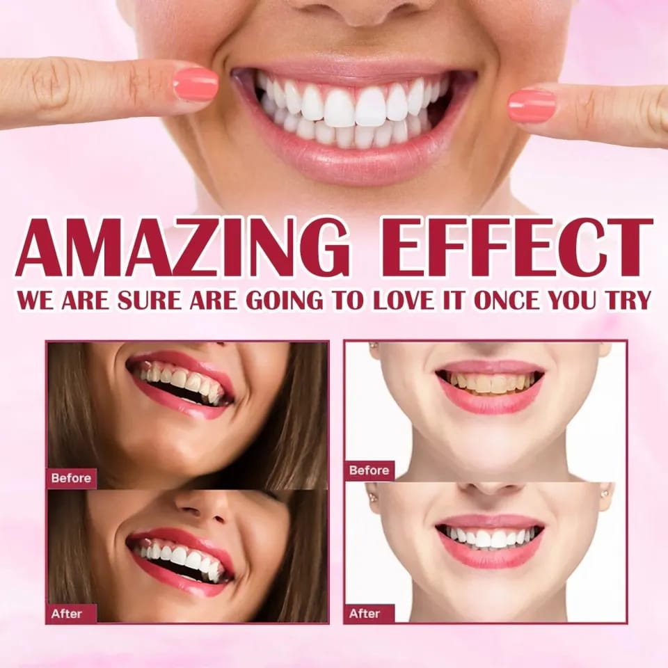 YAYASHI SP-4 Probiotic Whitening Toothpaste – Ultra+ Stain Removal, Fresh Breath & Dental Hygiene – Professional Care (120g)