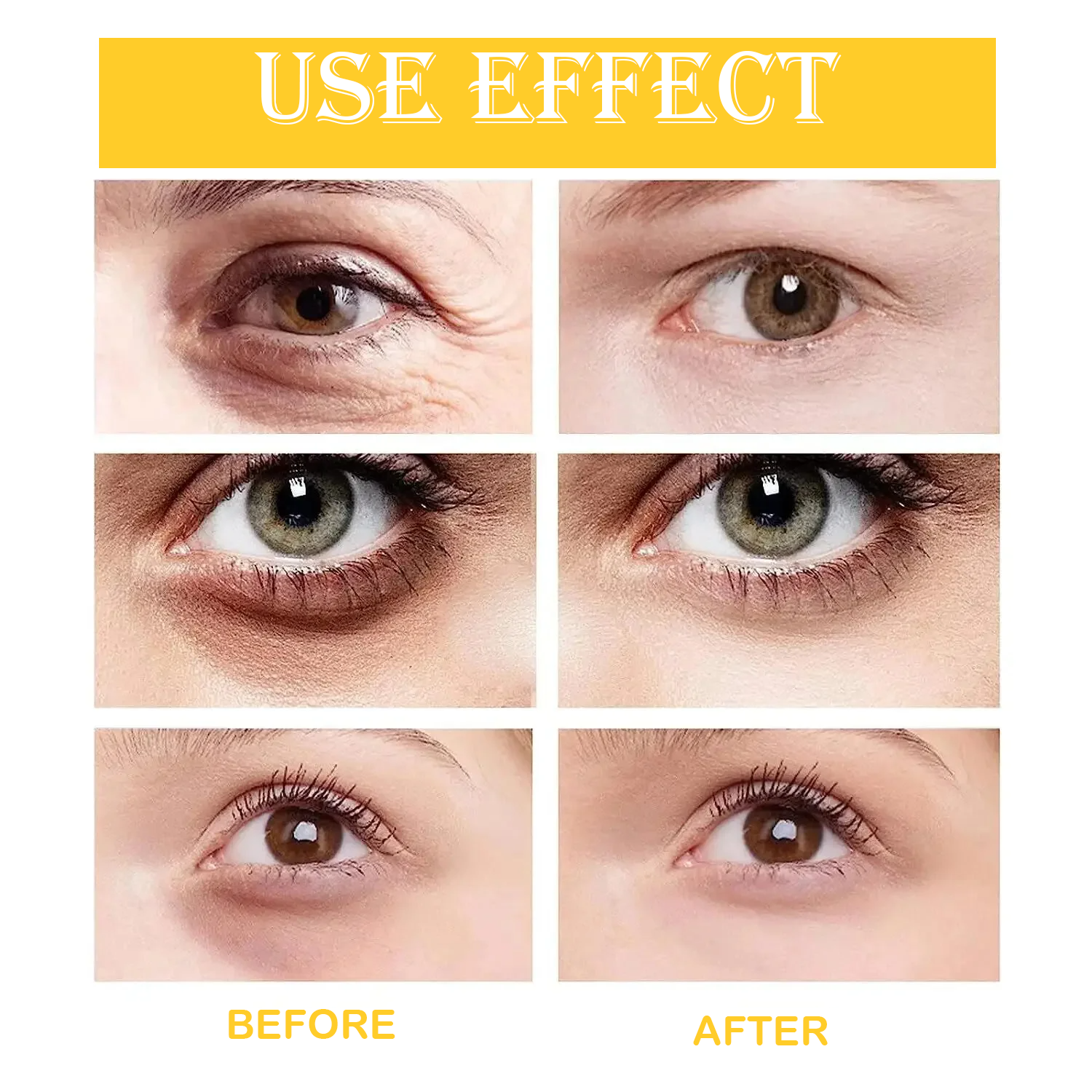 FORT Under Eye Gel Remove Dark Circles Fades Fine Lines Eye Bag Puffiness Anti-aging Tighten Anti Wrinkle Whiten Under Eyes Care 3oml