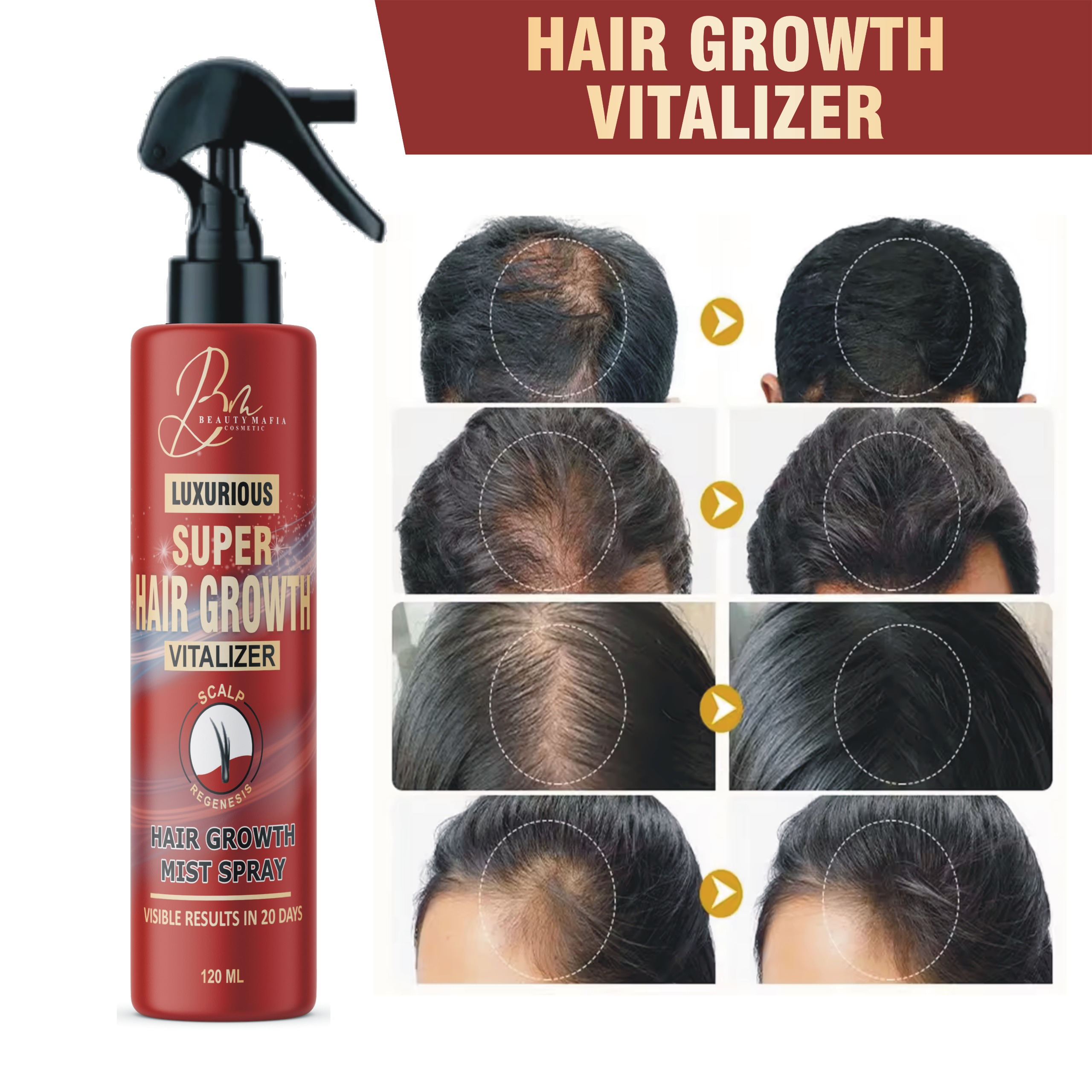 Beauty Mafia Hair Growth Spray |Hair Tonic for Hair Growth - Premium Hair Care Product Women and Men all Hair Types 120ml