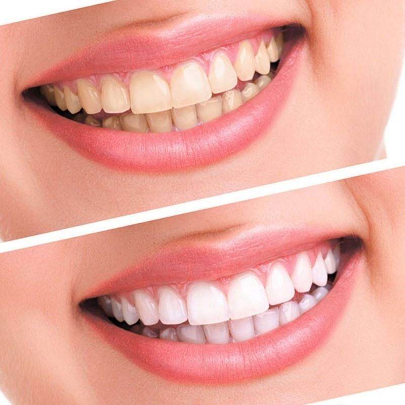 2Pcs/Bag Advanced Teeth Whitening Strips Teeth Oral Hygiene Care Dental Bleaching Teeth Strips Whitening Dental Bleaching Tools
