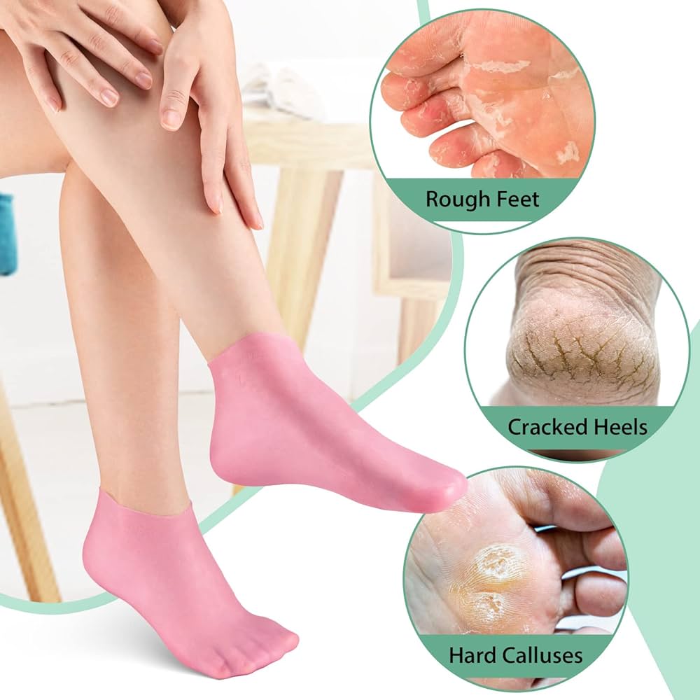 1 Pair Silicone Moisturizing Gel Heel Socks Exfoliating And Preventing  Dryness Foot Skin Rejuvenation Foot Care Elastic Sock Eatop