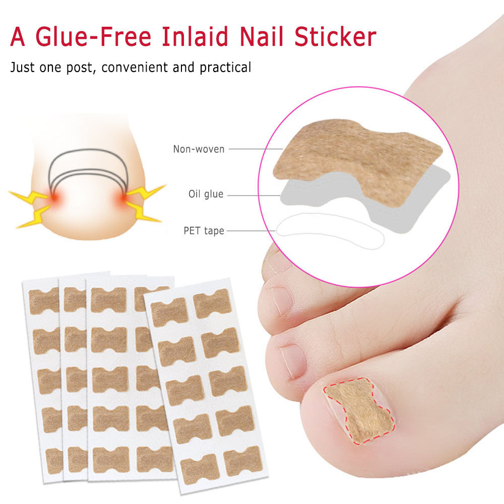 1pcs 5pcs Ingrown Toenails Correction Patch Elastic Cotton Toenail Pedicure Stickers Buy Online At Best Prices In Pakistan Daraz Pk