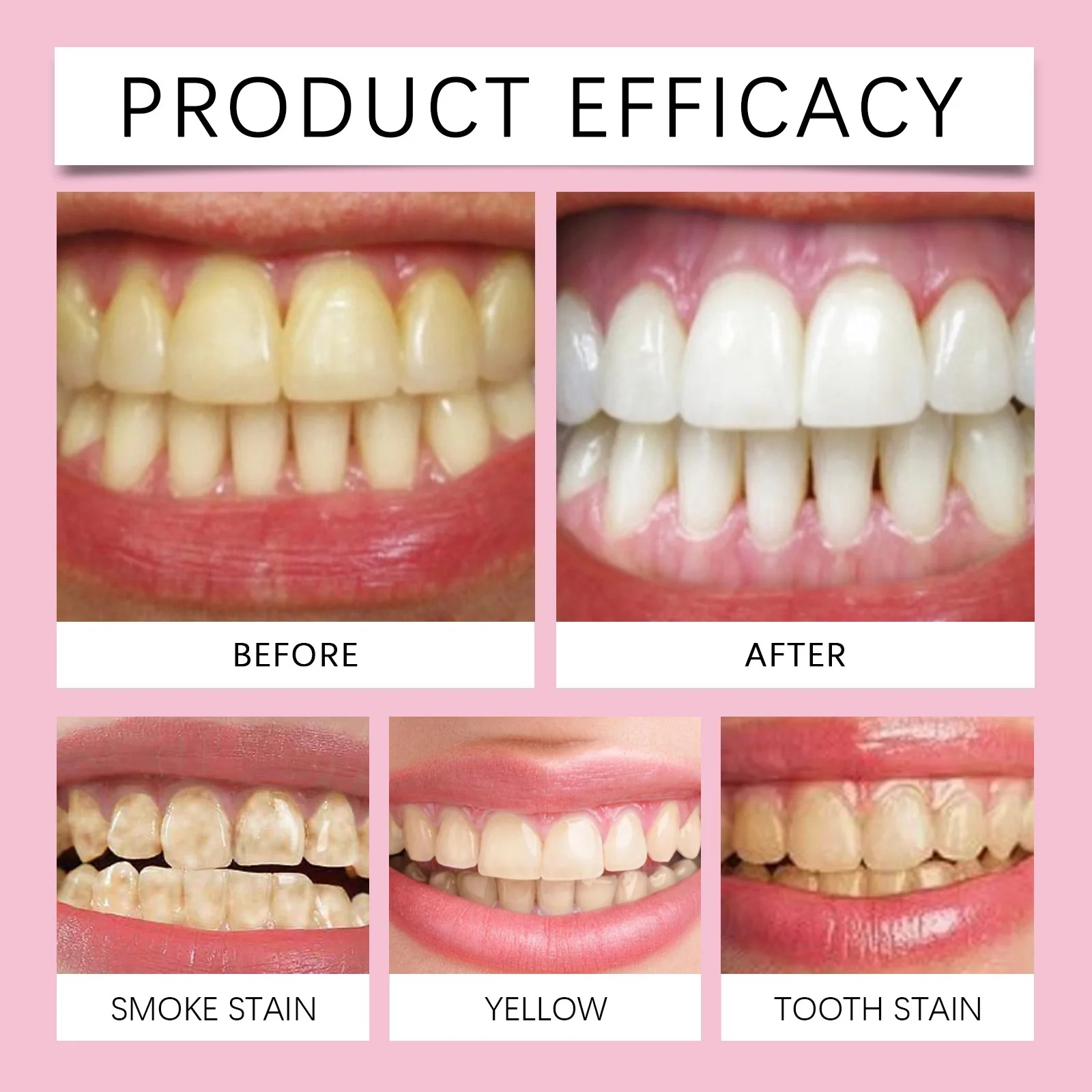 FORT Teeth Whitening Powder | Gentle & Effective Teeth Whitening Powder 100% Natural Strong Formula Dental Whitening Cleaning Powder | 50ml