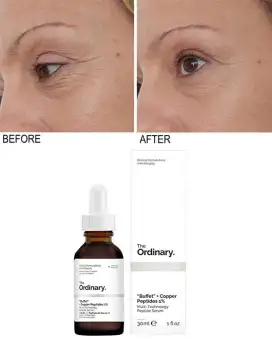 the ordinary buffet multi technology