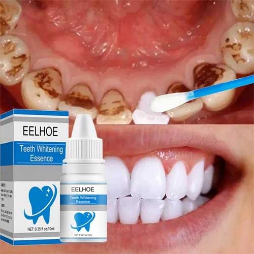 EELHOE New Cleaning Dental Care Oral Hygiene Remove Plaque Stains Teeth Whitening Essence Serum 10ml