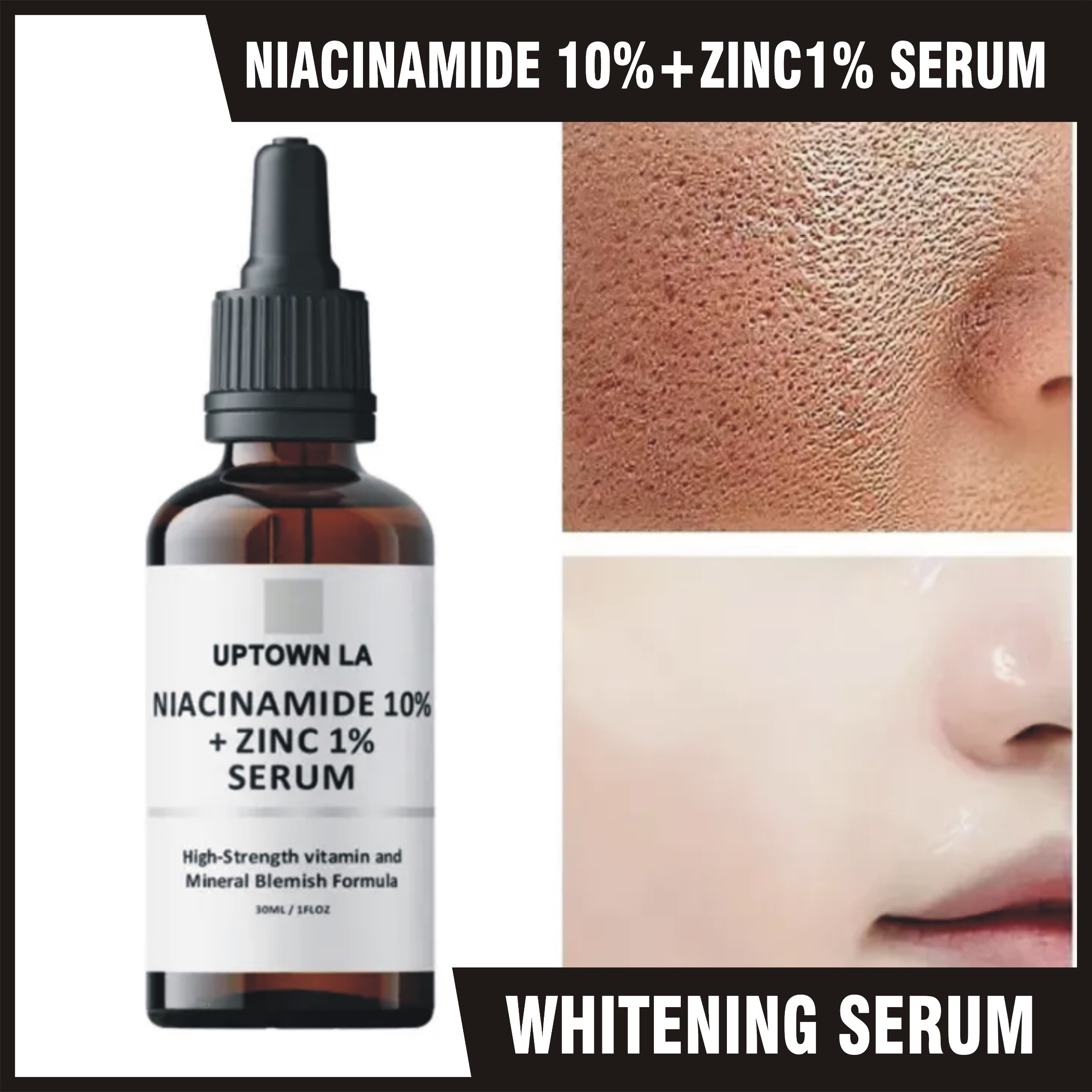 UPTOWN LA Niacinamide 10% + Zinc 1%  Radiance Boost Serum Formula for Clear and Glowing Skin
