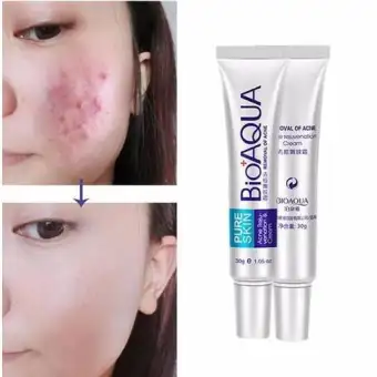 best cream to reduce pimples