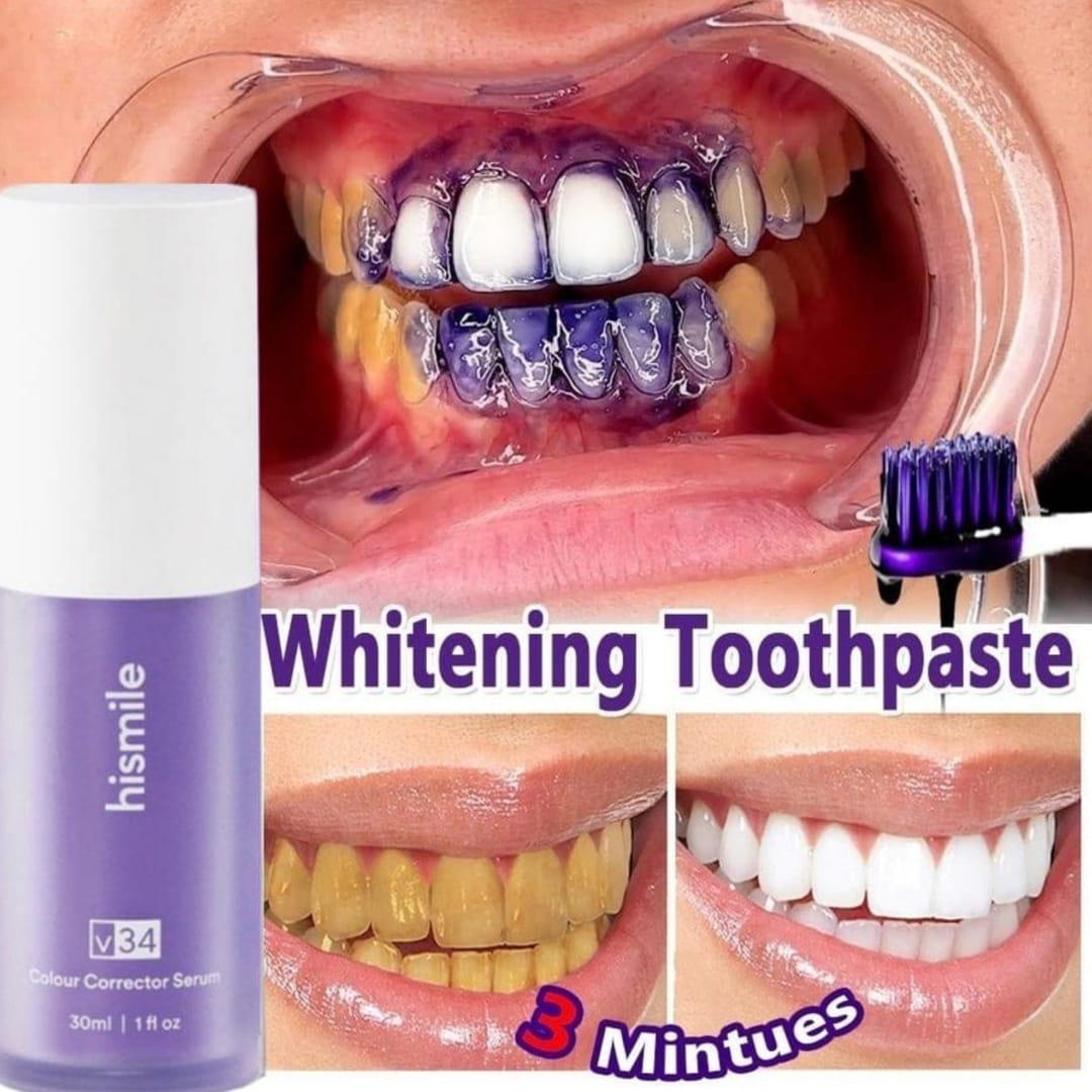 HISMILE V34 Teeth Removing Deep Smoke Stains Gingiva Protection Purple Orthopedic Toothpaste Cleans Oral Cavity Brightens Teeth