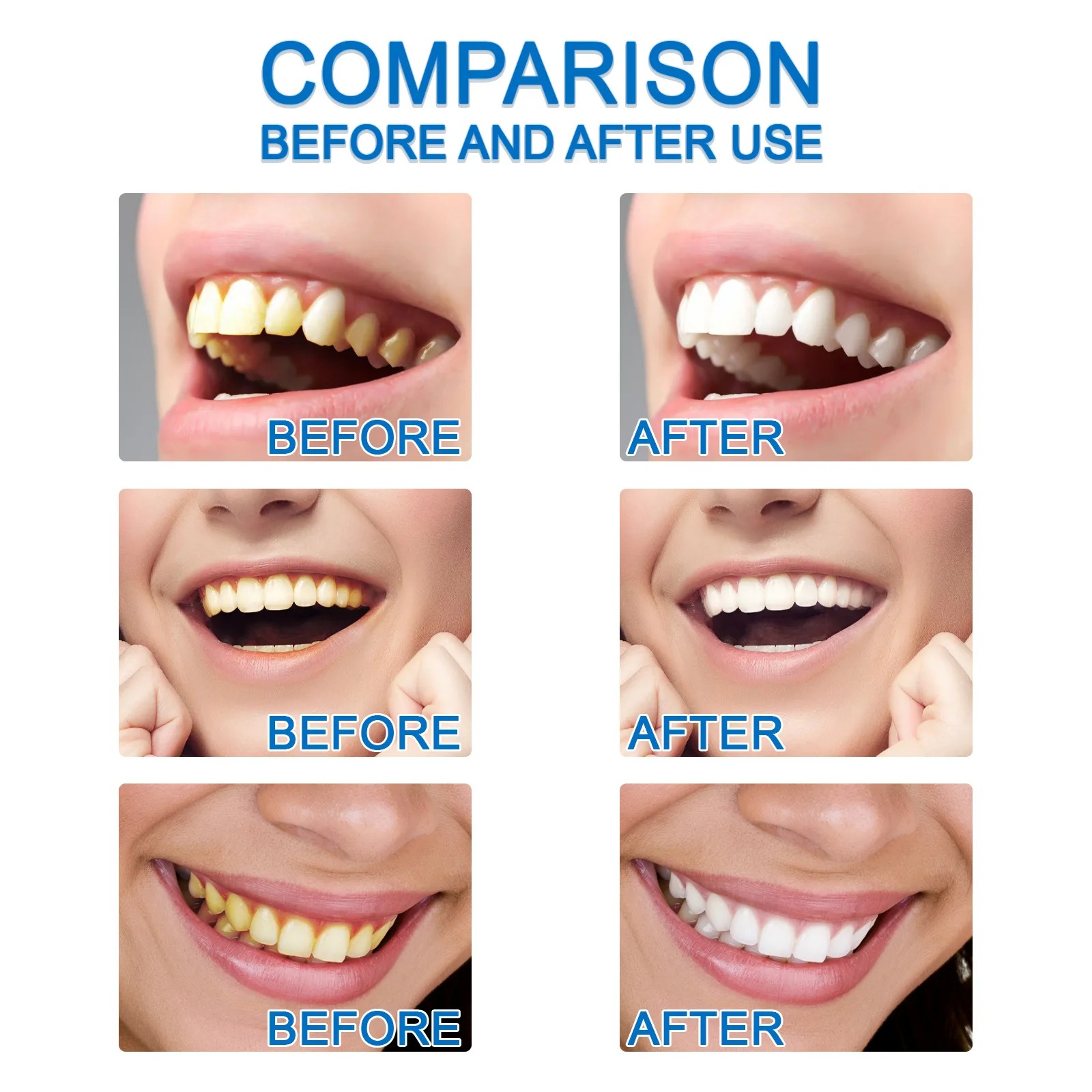 Teeth Cleaning Esence Naturally brighting Liquid | Teeth Whitening Powder Clean Oral Hygiene Whiten Teeth Remove Plaque Stains Fresh Breath Oral Hygiene Dental Tools 10ML