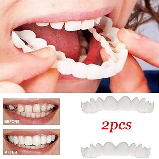 Snap-On Smile Teeth Veneers | Instant Whitening Tooth Cover for Men & Women | Reusable Cosmetic Denture for Confident Smile | Fake Teeth Veneers Kit (1Pair)