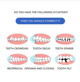 silicone teeth alignment