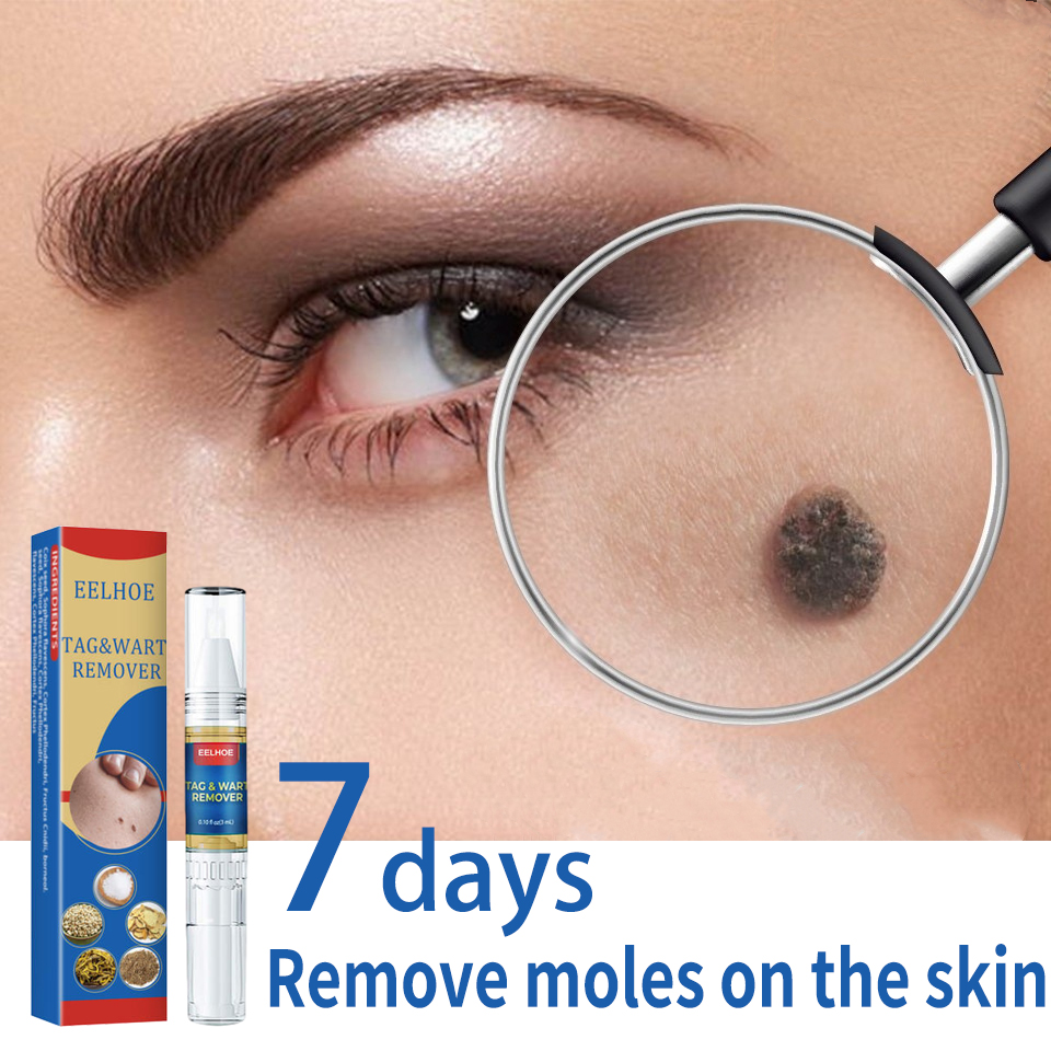 Skin Tag Wart Mole Remover Pen