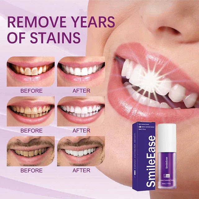 HISMILE V34 Teeth Removing Deep Smoke Stains Gingiva Protection Purple Orthopedic Toothpaste, Purple Teeth Whitening Toothpaste Kit