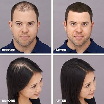 King Hair Fibers 27.5g Black Alternative Toppik & Caboki Hair Fiber Premium Quality Hair Fibers