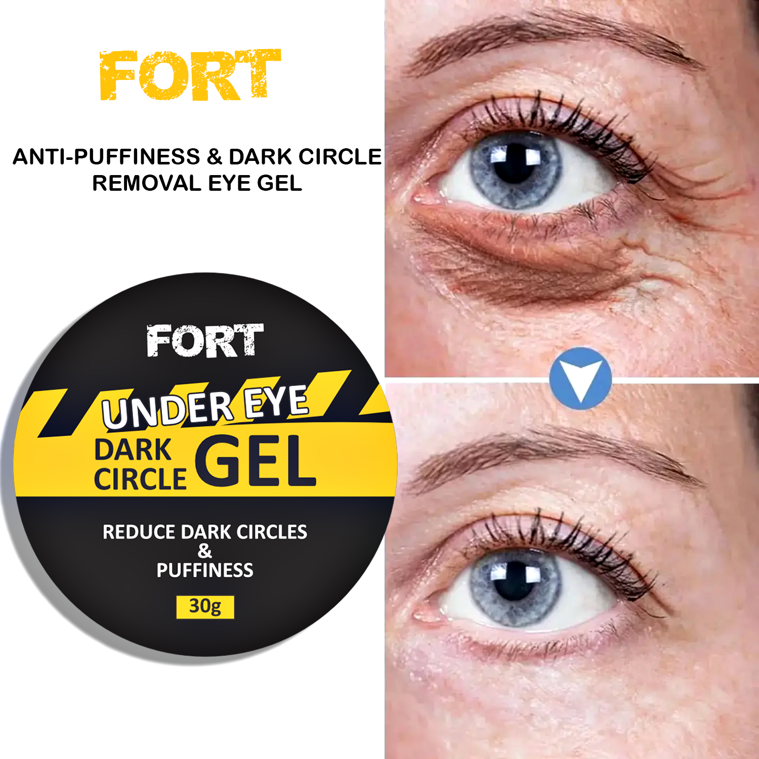 FORT Under Eye Gel Remove Dark Circles Fades Fine Lines Eye Bag Puffiness Anti-aging Tighten Anti Wrinkle Whiten Under Eyes Care 3oml