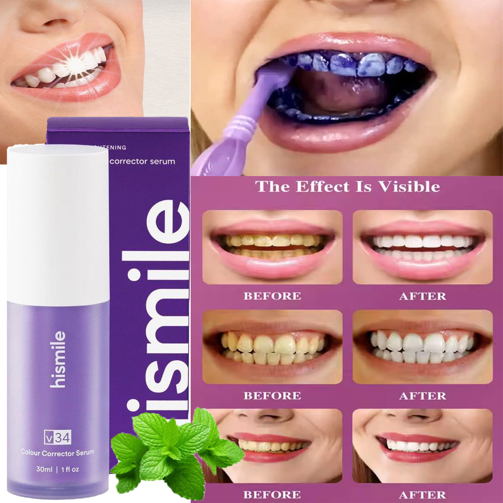 Online Karachi Hismile V34 Purple Color Corrector Serum – Advanced Teeth Whitening Toothpaste for Effective Stain Removal and Oral Cleaning | Daraz .pk