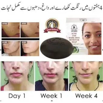 acne and dark spot remover