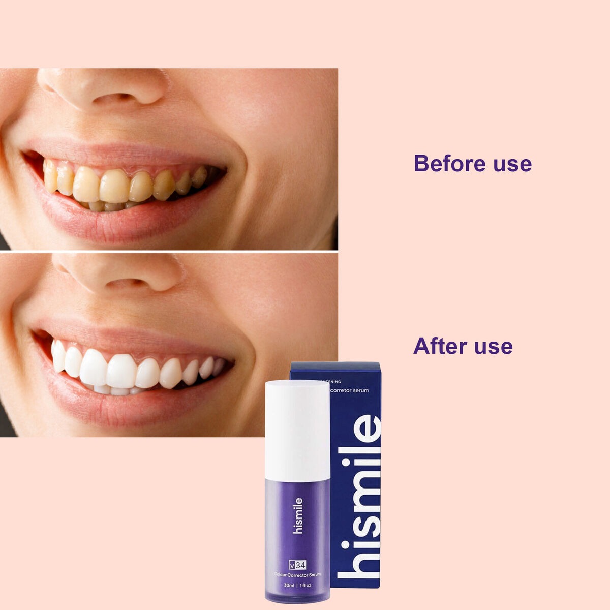 HISMILE V34 Teeth Removing Deep Smoke Stains Gingiva Protection Purple Orthopedic Toothpaste, Purple Teeth Whitening Toothpaste Kit