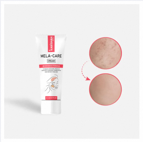 Mela Care Advanced Brightening Cream  Mela Care Advanced Brightening Cream.