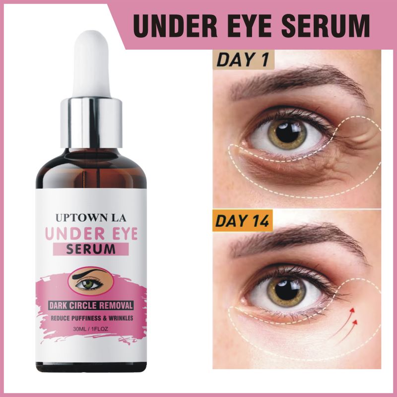 UPTOWN LA Under Eye Serum for Puffiness, Dark Circles, Fine Lines, Anti-Aging and Wrinkle - 30ml