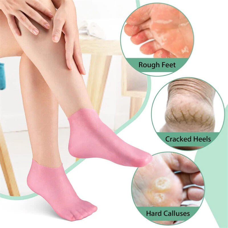 Silicone Gel Heel Repair Socks for Men & Women | Moisturizing Foot Socks for Cracked Heels, Dry Rough Feet & Hard Calluses | Reusable Foot Care Treatment Socks