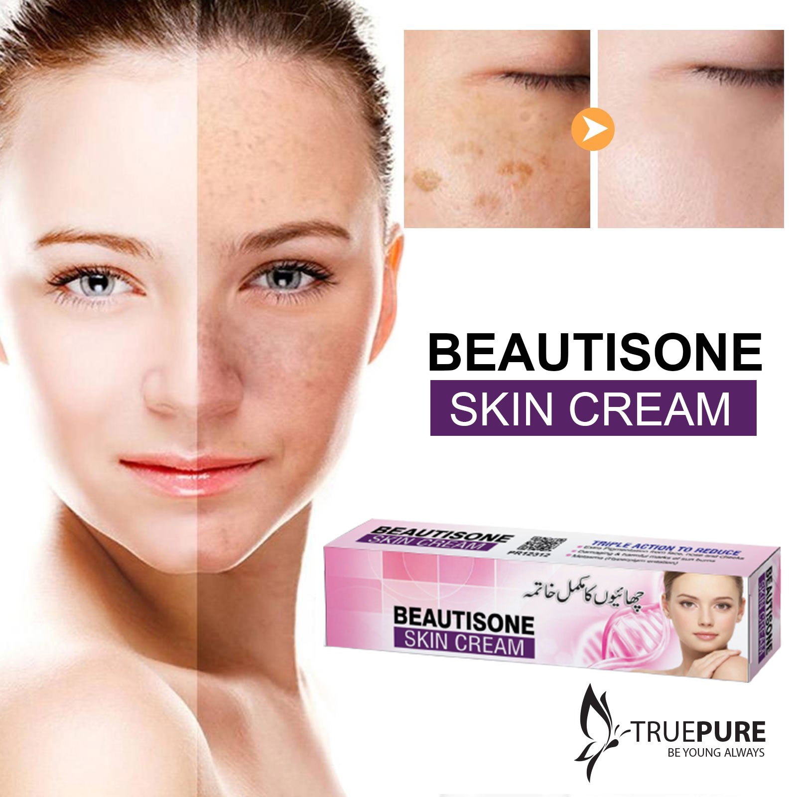 Best Cream For Melasma In Pakistan atelieryuwa.ciao.jp