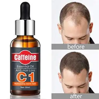 Fast Powerful Hair Growth Essence Hair Loss Products Essential Oil