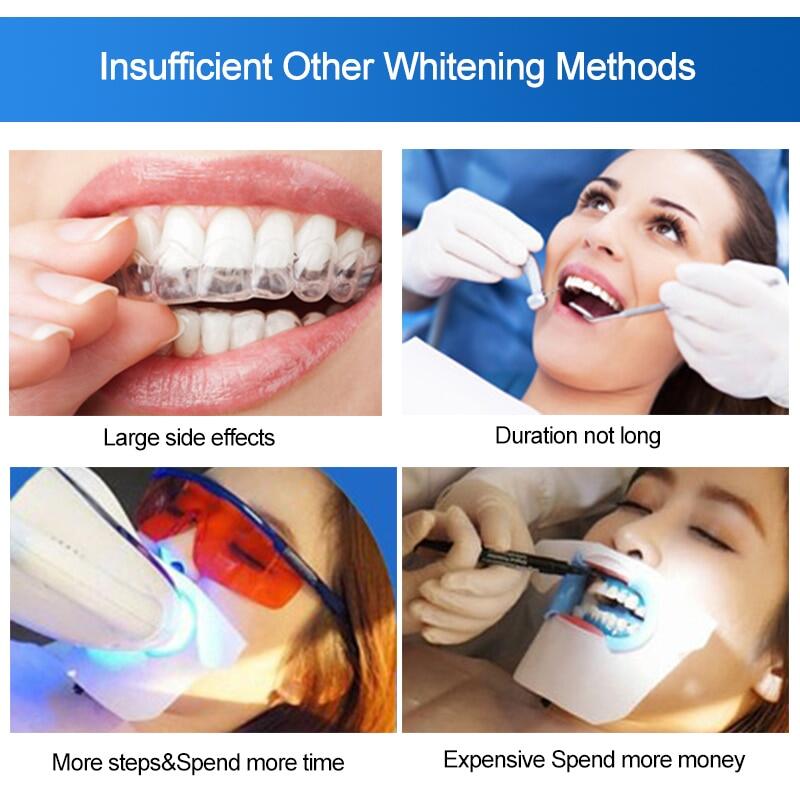 Professional Teeth Whitening Strips – Oral Hygiene