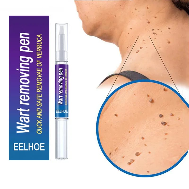 Removal Of Warts Liquid Pen Woman Skin Care Removing Against Moles Patch Remove Black Dot Emulsion