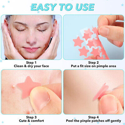 40Pcs Colorful Cute Star Shaped Acne Treatment Sticker Invisible Acne Cover Removal Pimple Patch Skin Care