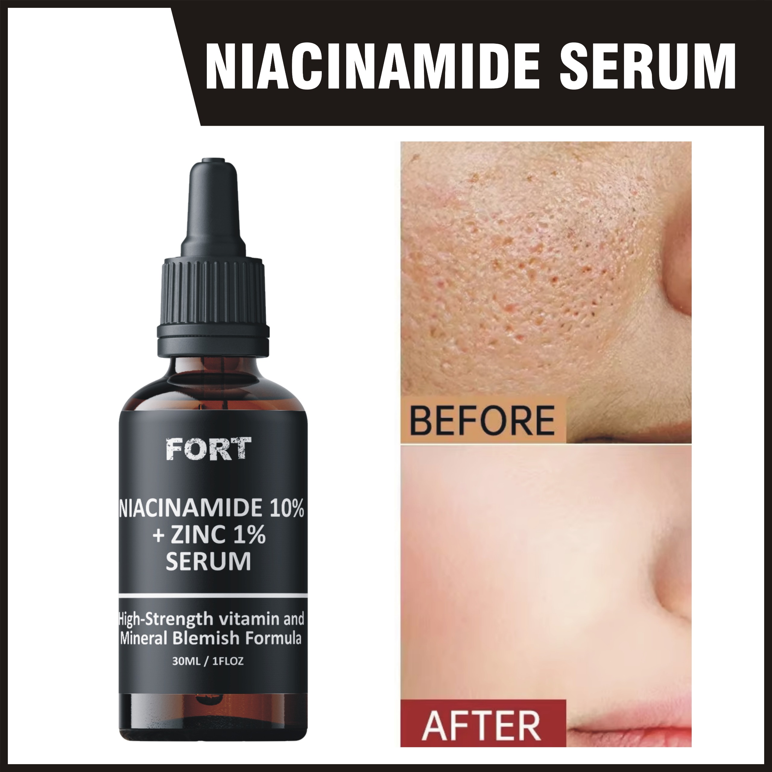 FORT Niacinamide 10 % and Zinc 1% PCA Radiance Boost Serum Formula for Clear and Glowing Skin