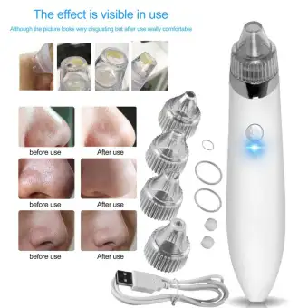 best face vacuum cleaner