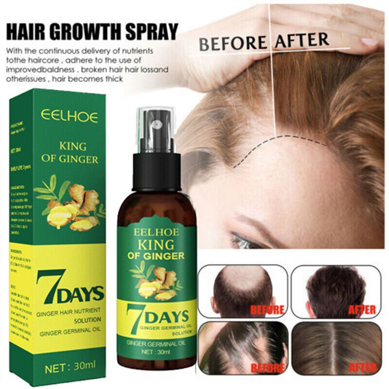 7 Days Hair Growth serum with Derma Roller With 540 Micro Needle Skin Therapy 0.50mm  Natural Hair Treatment Effective Fast Growth Hair Care