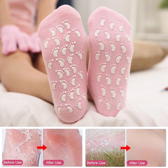 Silicone Gel Heel Pad Socks For Pain Relief And Anti Crack Heel 1 Pair Heel Cups Heel Guards Heel Protectors Heel Sleeves For Relieve Heel Pads Cushion Heel Pain, Heal Dry Cracked Heels, Achilles Tendinitis, For Men & Women