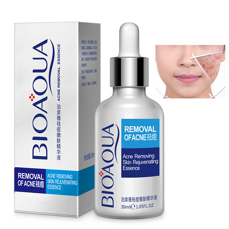 BIOAQUA Pure Skin Acne Removal Serum Anti Acne Essence Brightening &  Moisturizing Facial Serum Acne Solution Face Serum Bqy57621 | Daraz.pk