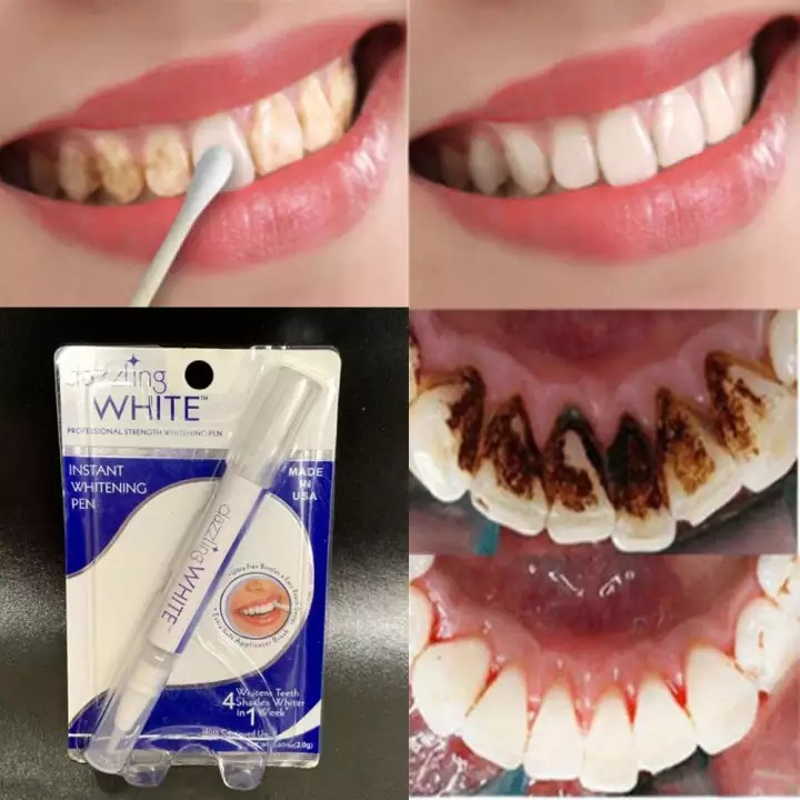 Teeth Whitening Gel Pen White Teeth Cleaning Serum Oral Care Hygiene Essence Remove Stains Dental Bleaching Teeth Whitener