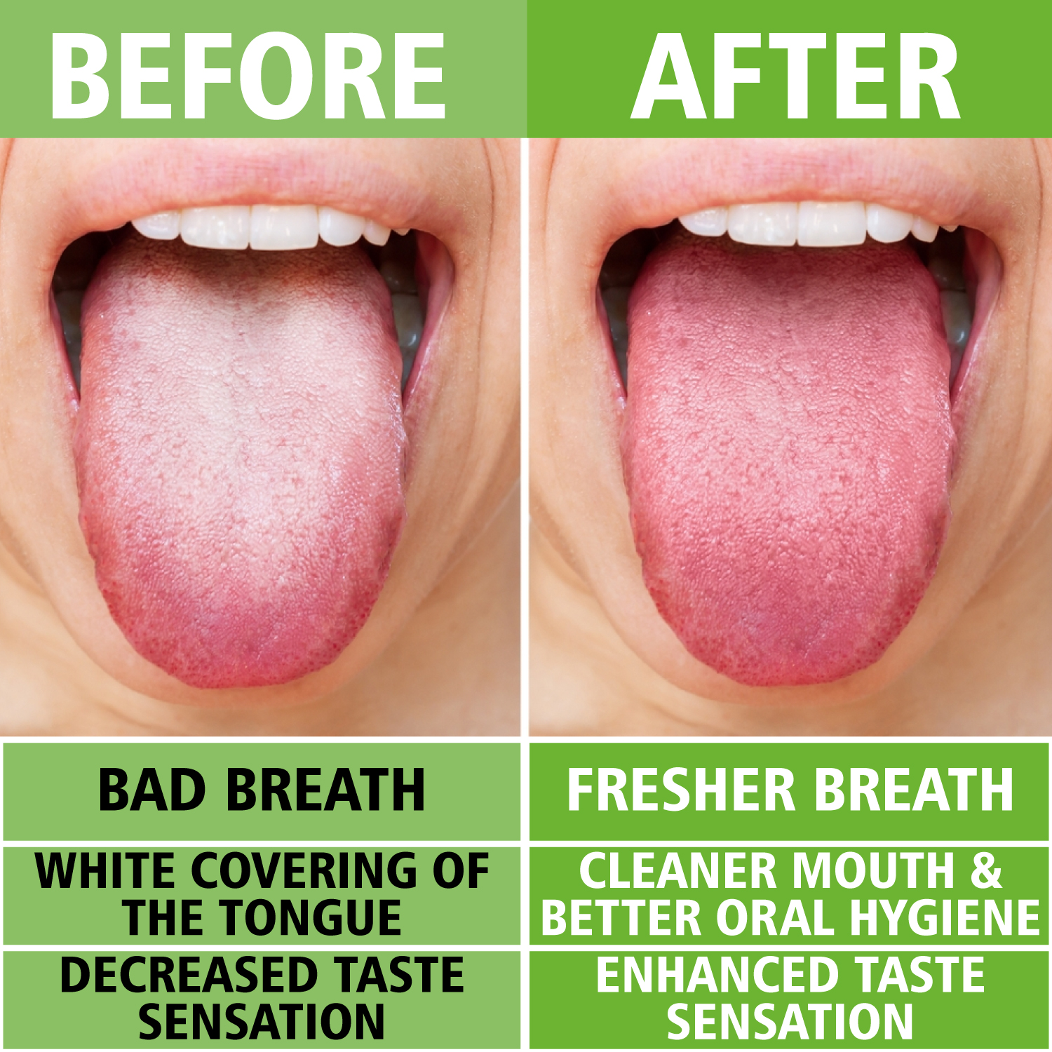 Dealspo NARZ Tongue Scraper Stainless Steel Tongue Cleaner Bad Breath Treatment Restore Fresh Breath Improve Taste And Oral Health Suitable For Men And Women Personal Hygiene