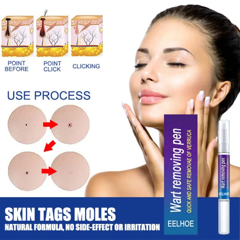 Removal Of Warts Liquid Pen Woman Skin Care Removing Against Moles Patch Remove Black Dot Emulsion