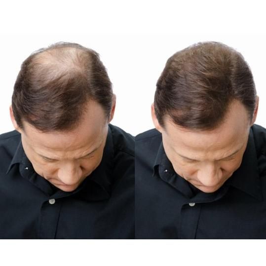 King Hair Fibers 27.5g Black Alternative Toppik & Caboki Hair Fiber Premium Quality Hair Fibers