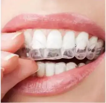 silicone teeth alignment