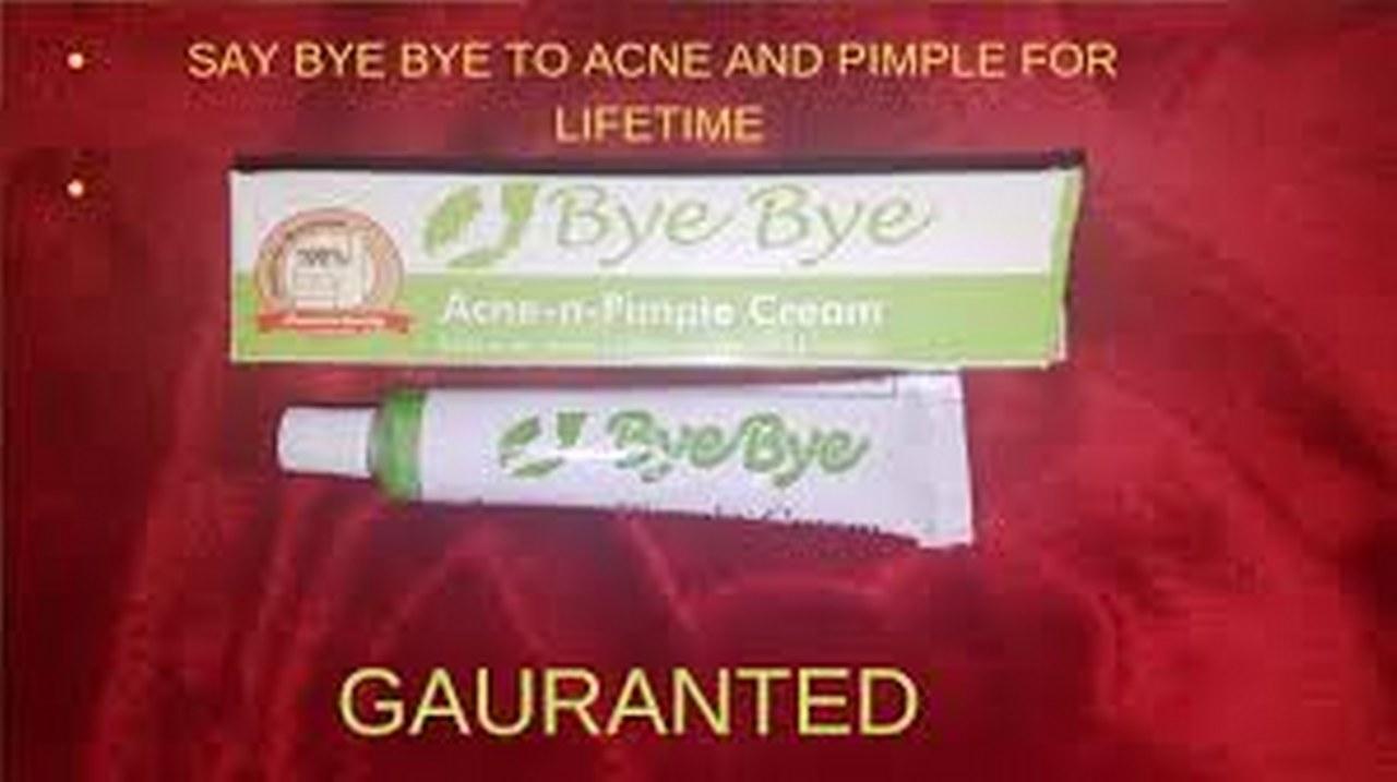 bye bye acne cream