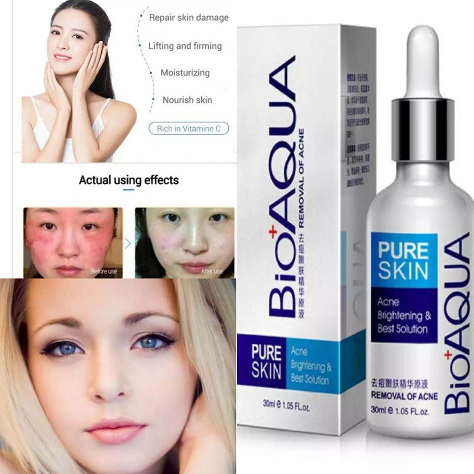 pure skin bioaqua