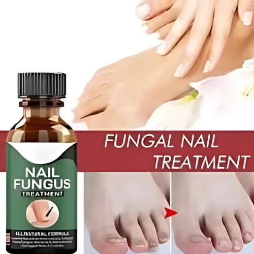 Fast Nail Fungal Treatments Oil Nail Repair Essences Serum Care Treatments Foot Nail Fungus Removal Gel Paronychia Onychomycosis