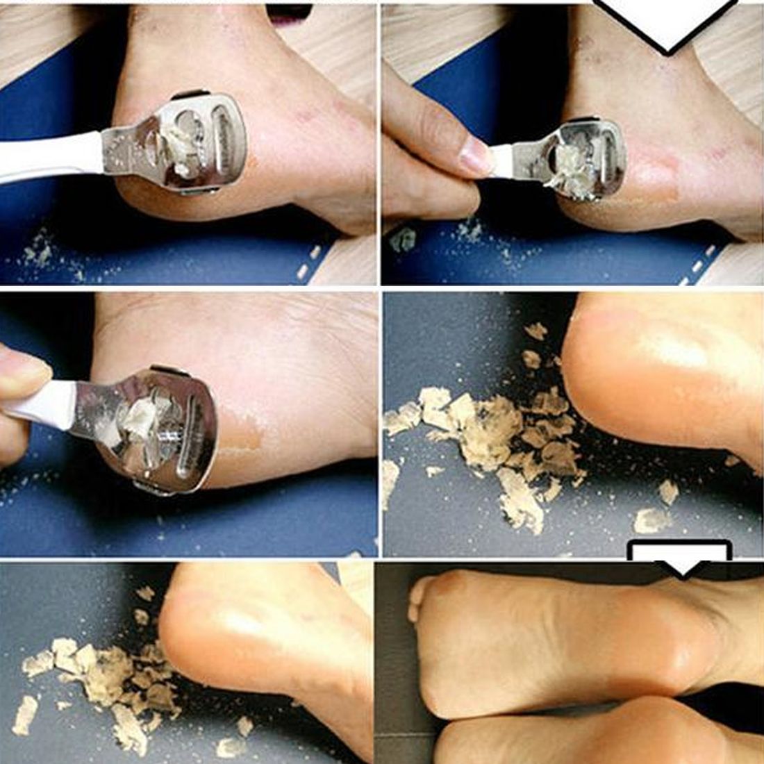 Tool to scrape sale dead skin off feet