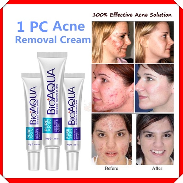 aqua acne cream